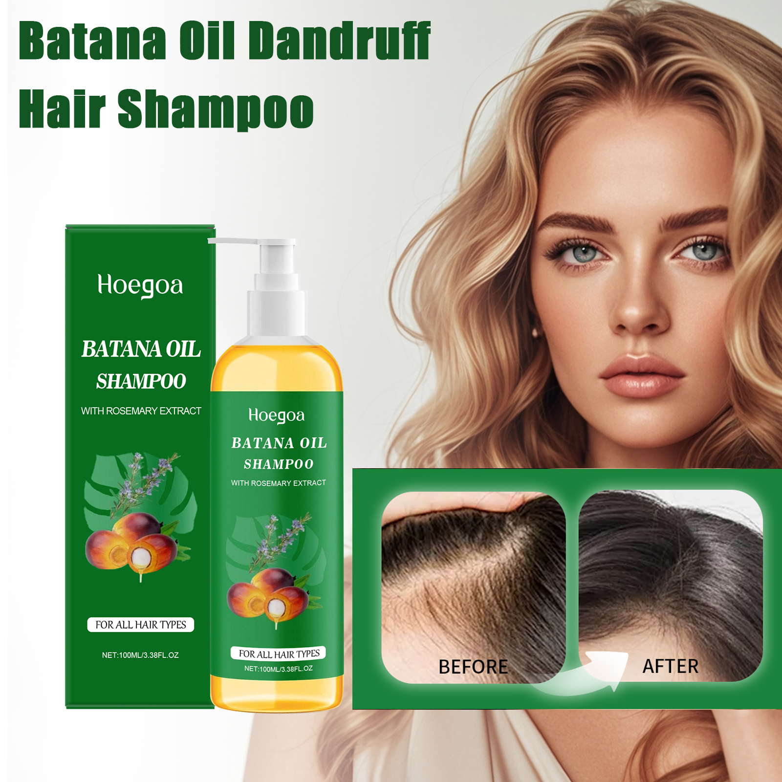 Hair Care Dandruff - Hair Booster Batana Oil Shampoo Long