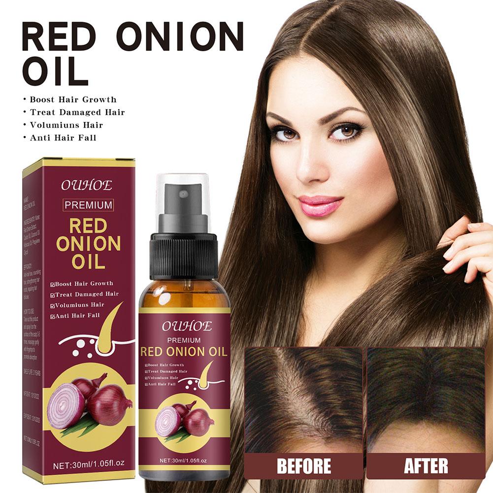 Hair Care With Rice Water - 1/3/5PCS Red Onion Essential Oil Spray