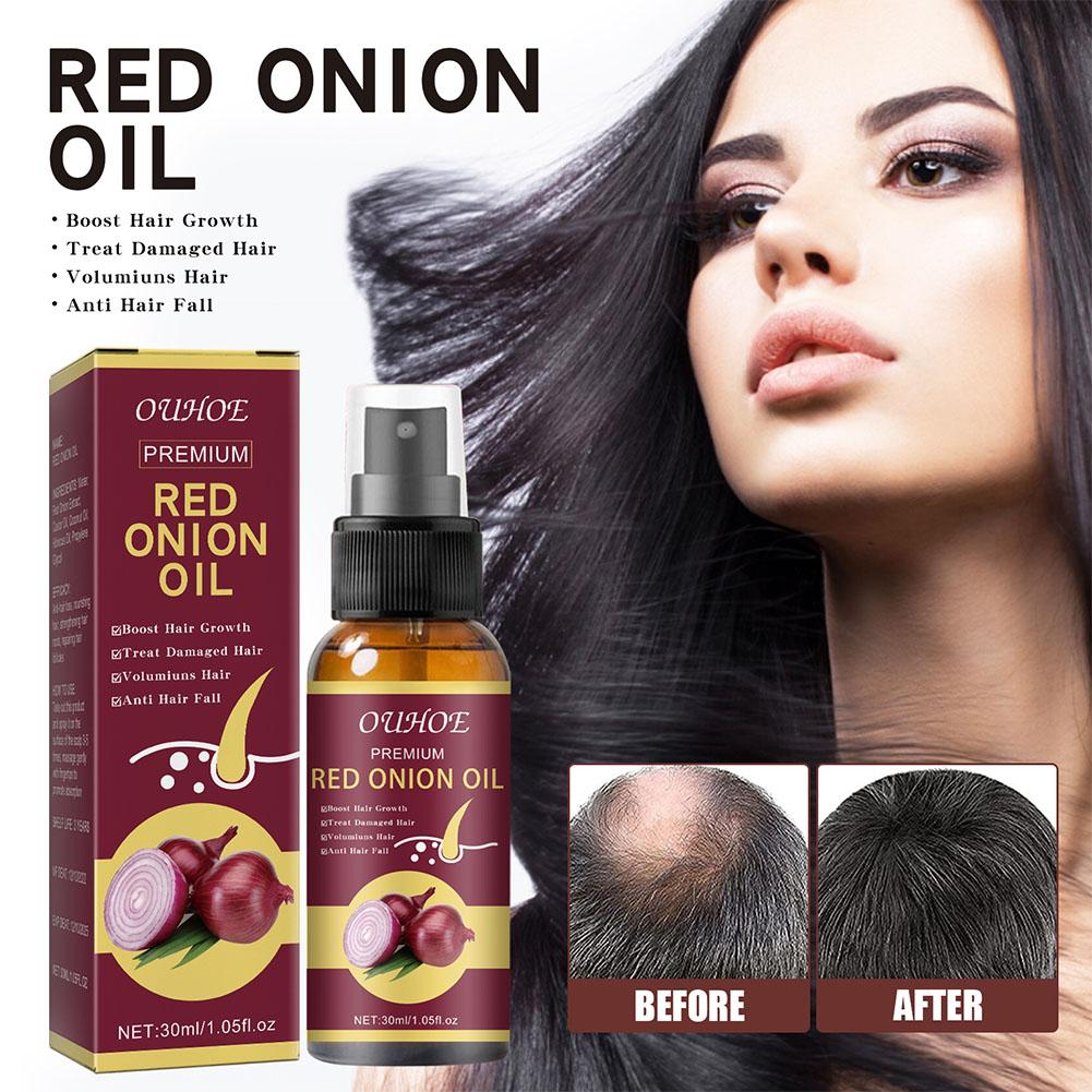 1/3/5PCS Red Onion Essential O - Hair Care With Rice Water recensie en prijs