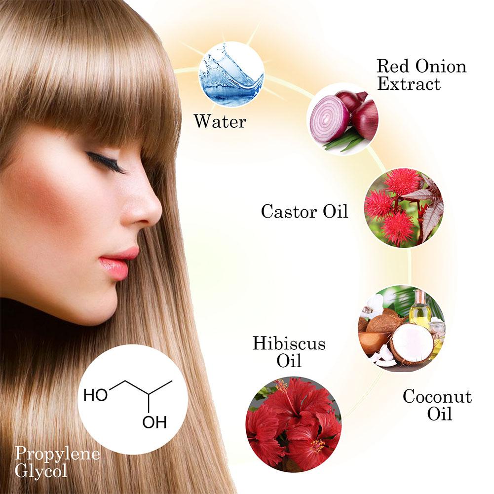 1/3/5PCS Red Onion Essential O - Hair Care With Rice Water recensie en prijs
