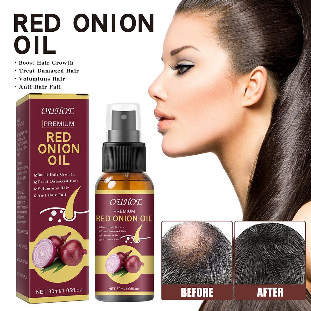 1/2/3pcs Red Onion Essential O - Hair Care With Rice Water recensie en prijs