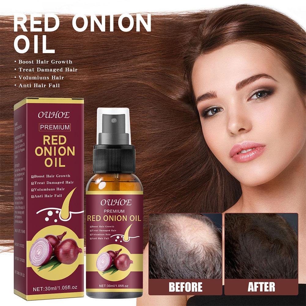 1/2/3pcs Red Onion Essential O - Hair Care With Rice Water recensie en prijs