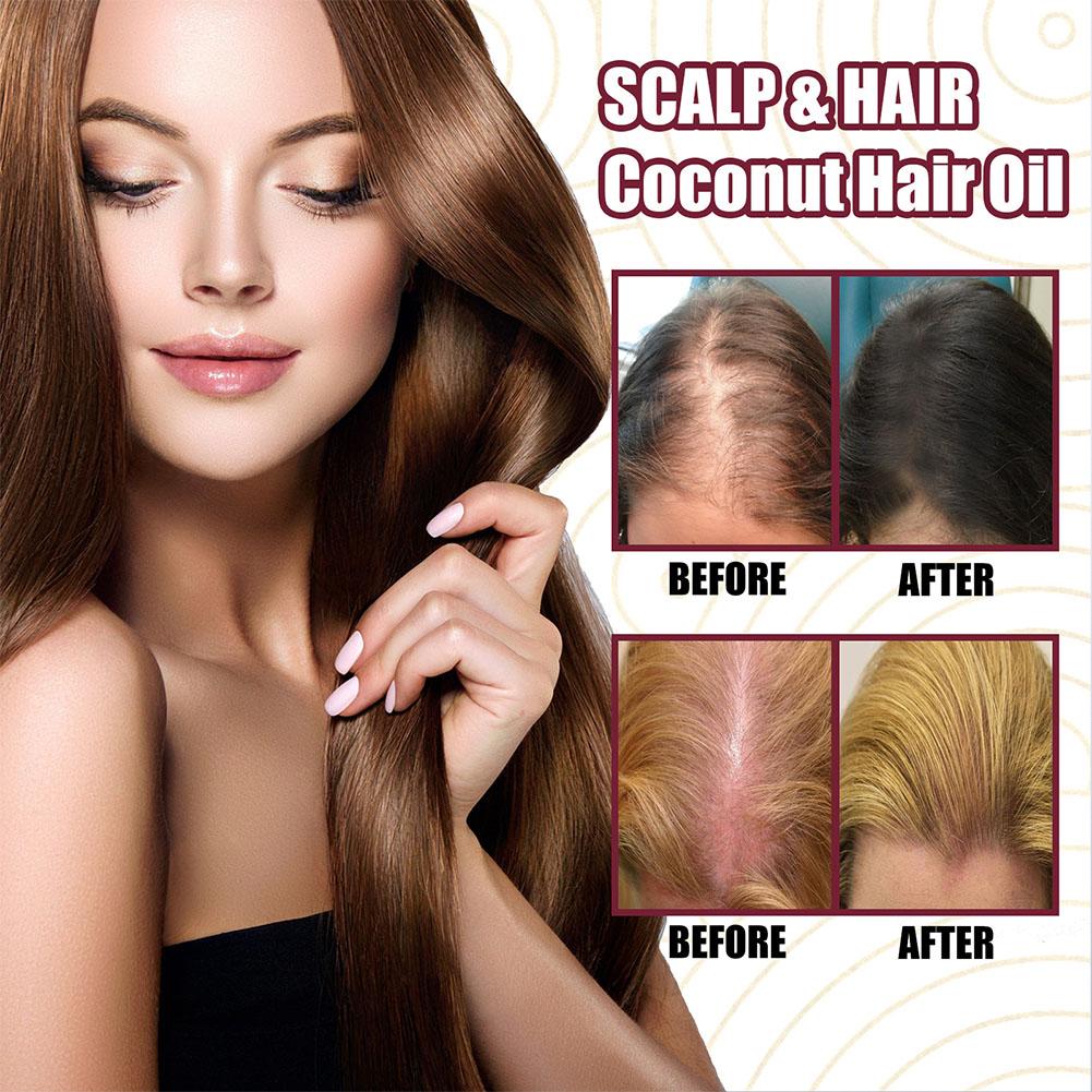 1/2/3pcs Red Onion Essential O - Hair Care With Rice Water recensie en prijs