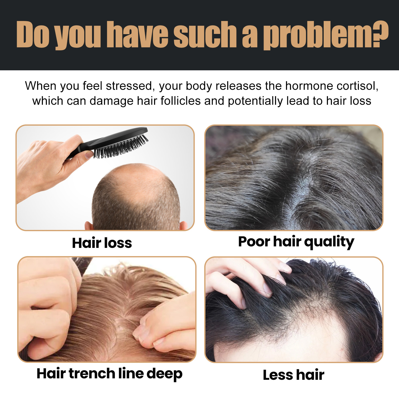 Shampoo for Fast Hair Growth R - Hair Care Dandruff recensie en prijs
