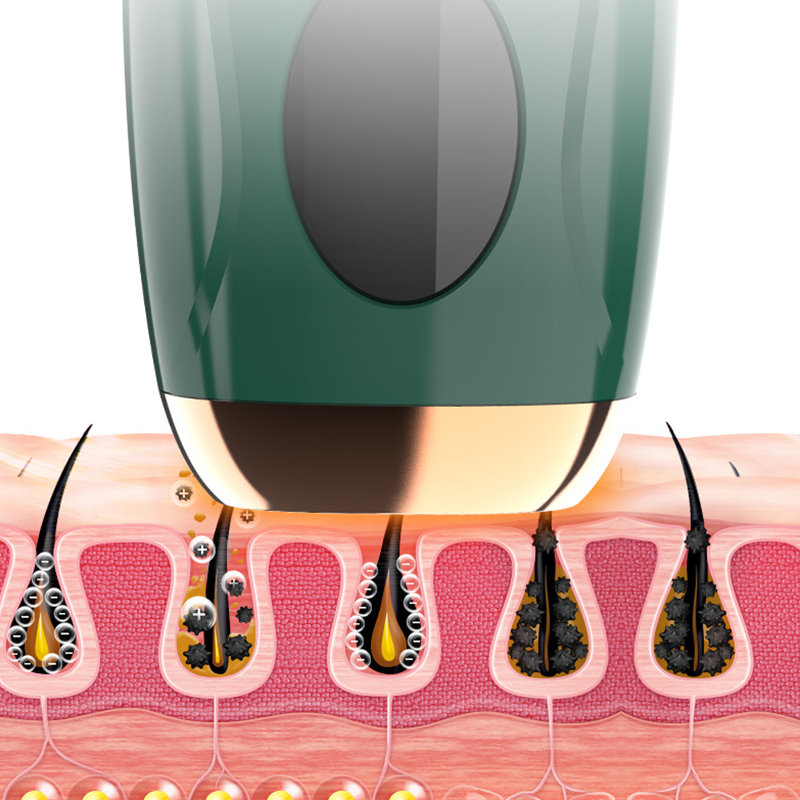 Portable IPL Laser Hair Remova - From Home Hair Care recensie en prijs