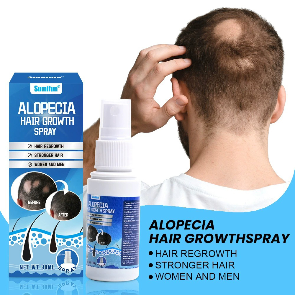 Alopecia Hair Growth Spray Sop - Hair Care Spray recensie en prijs