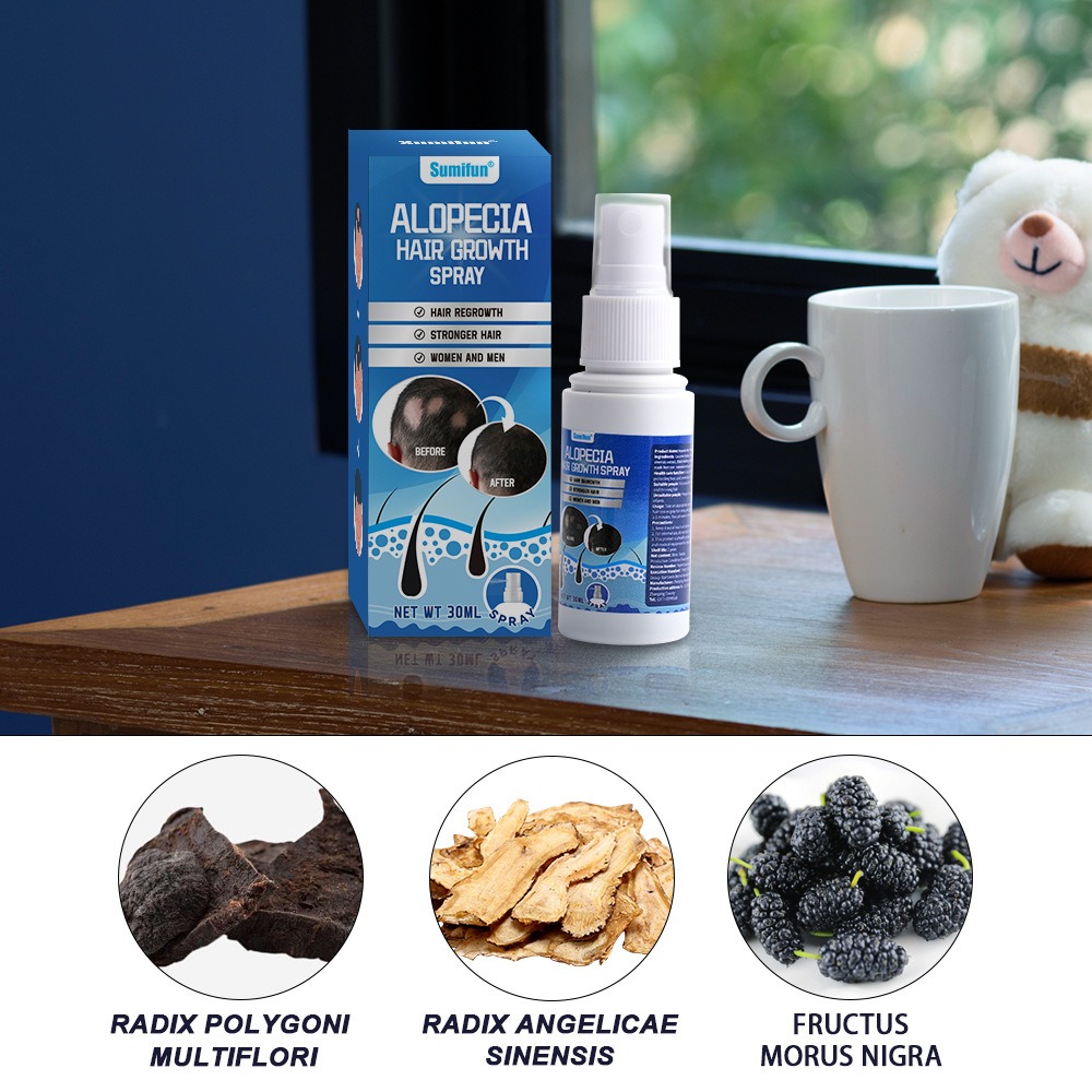 Alopecia Hair Growth Spray Sop - Hair Care Spray recensie en prijs