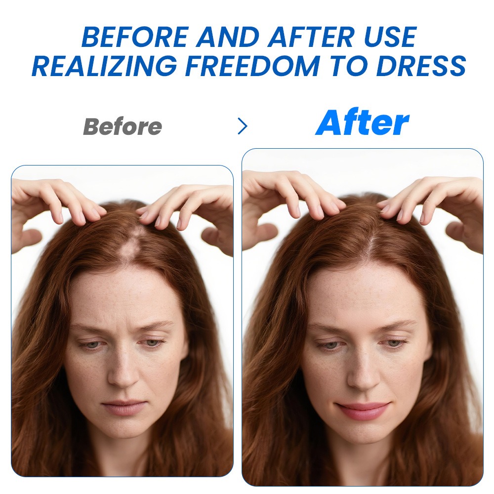 Alopecia Hair Growth Spray Sop - Hair Care Spray recensie en prijs