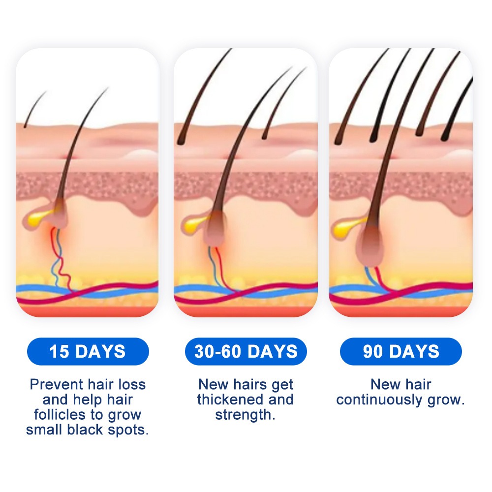 Alopecia Hair Growth Spray Sop - Hair Care Spray recensie en prijs