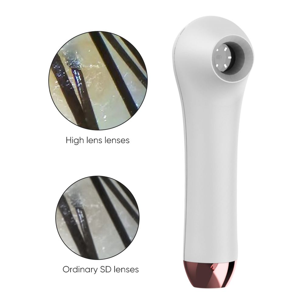 Home Use HD Dermatology Face S - Hair Care Homemade recensie en prijs