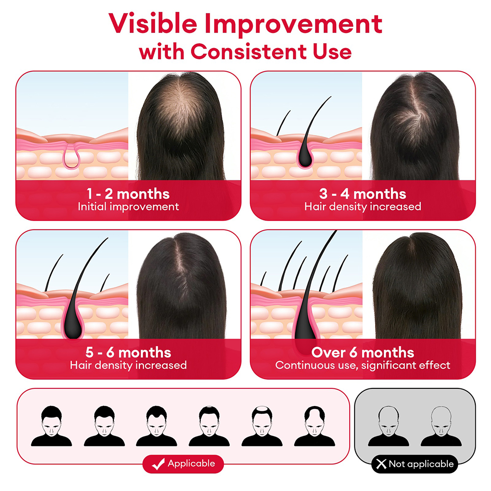 650nm+850nm Red Light Infrared - Hair Care With Protein recensie en prijs