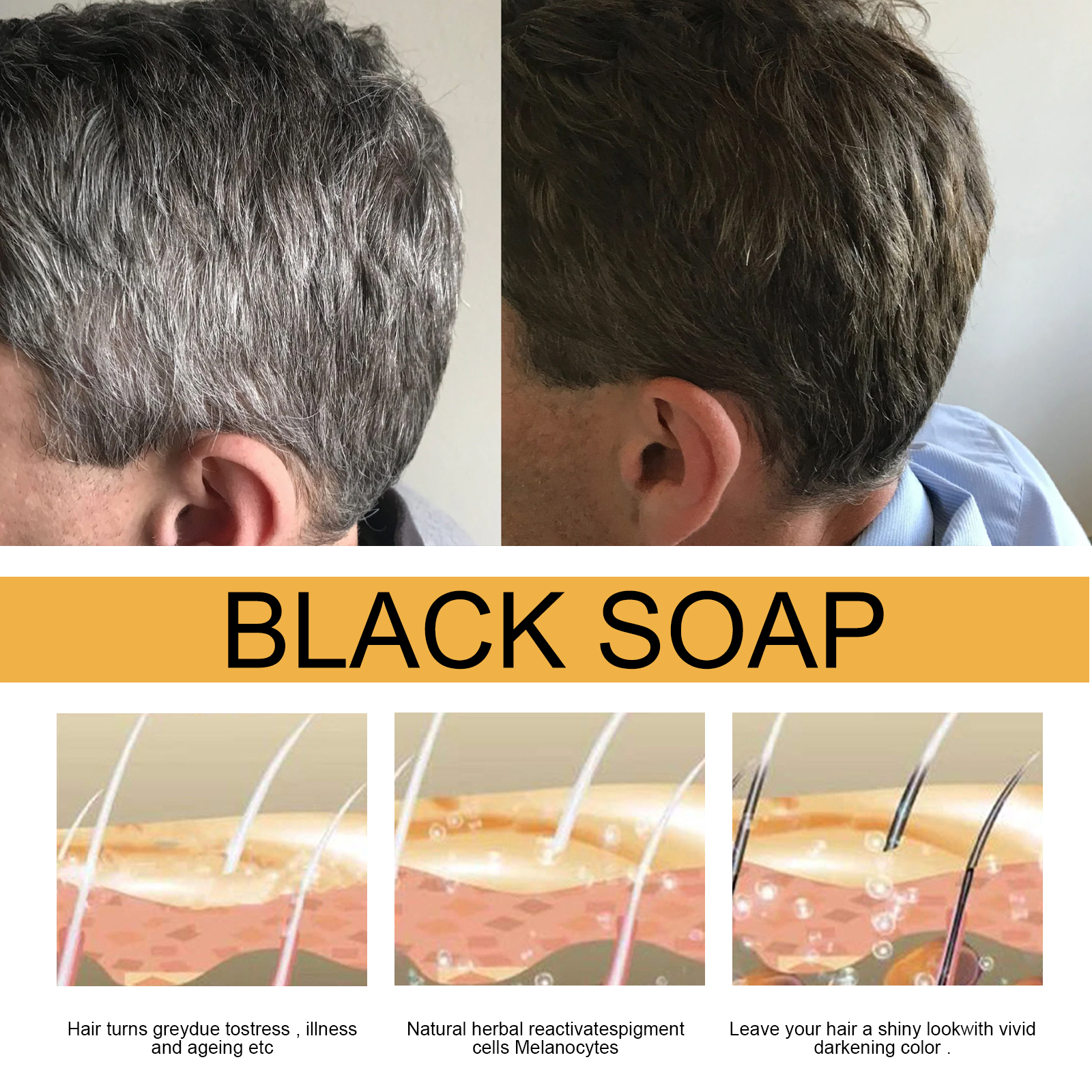 Hair Shampoo Soap Polygonum Mu - Hair Care Dandruff recensie en prijs