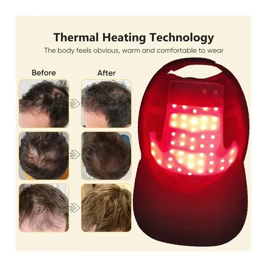 NEW LED Red Blue Light Therapy - Hair Care With Protein recensie en prijs