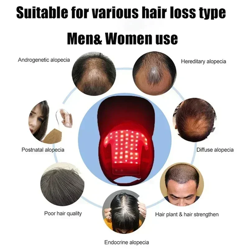 NEW LED Red Blue Light Therapy - Hair Care With Protein recensie en prijs