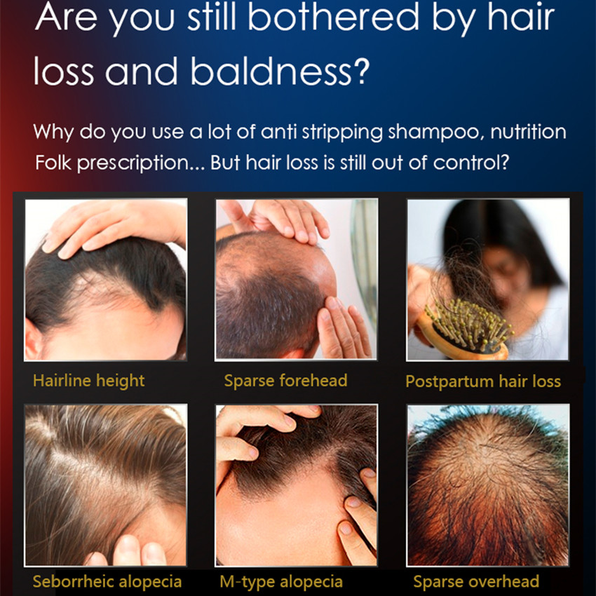 Laser Hair Growth Comb Electri - Hair Care With Protein recensie en prijs
