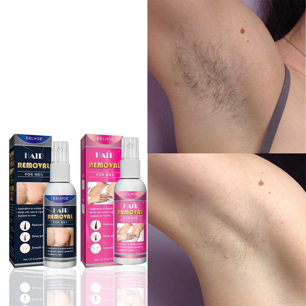 1/2PCS Super Natural Painless  - Hair Care Spray recensie en prijs