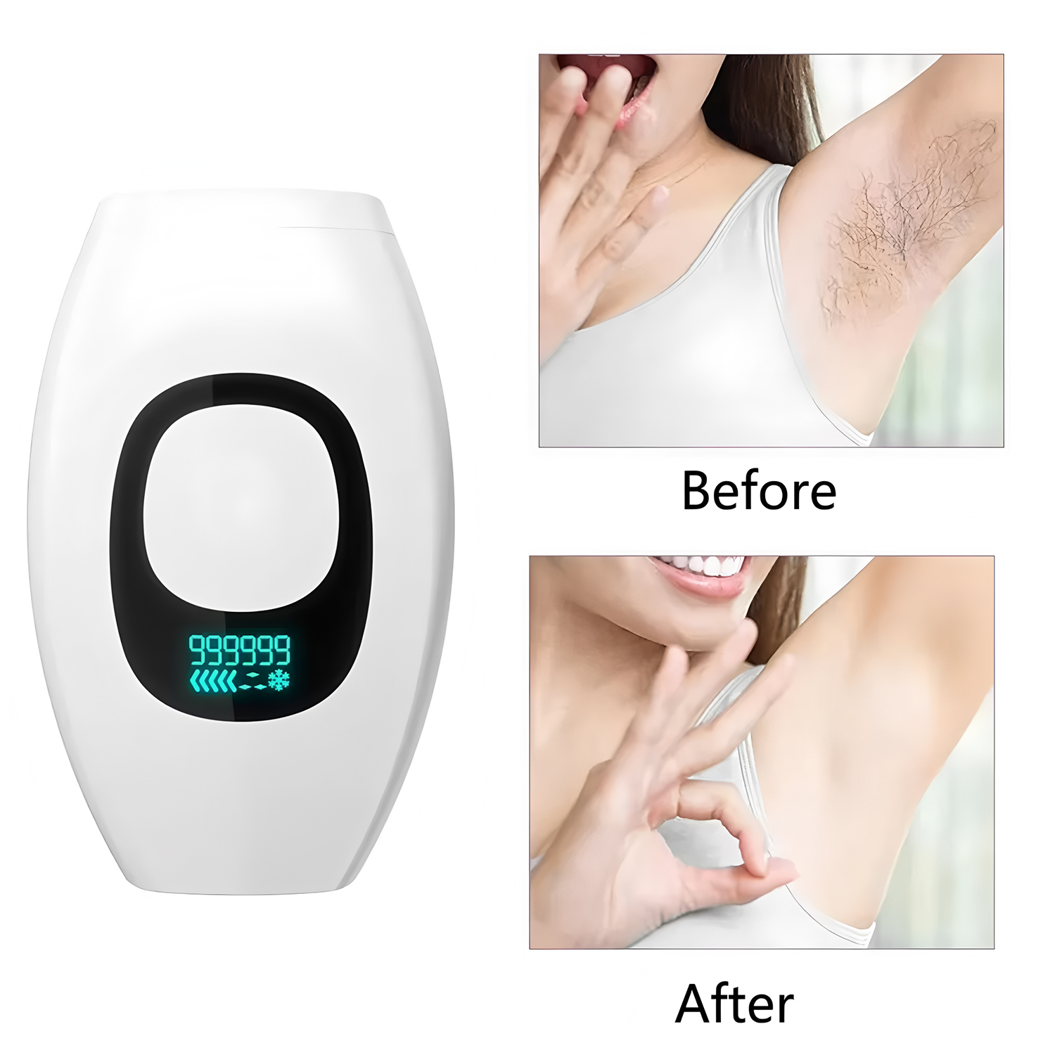 Beauty Care IPL Hair Removal D - From Home Hair Care recensie en prijs