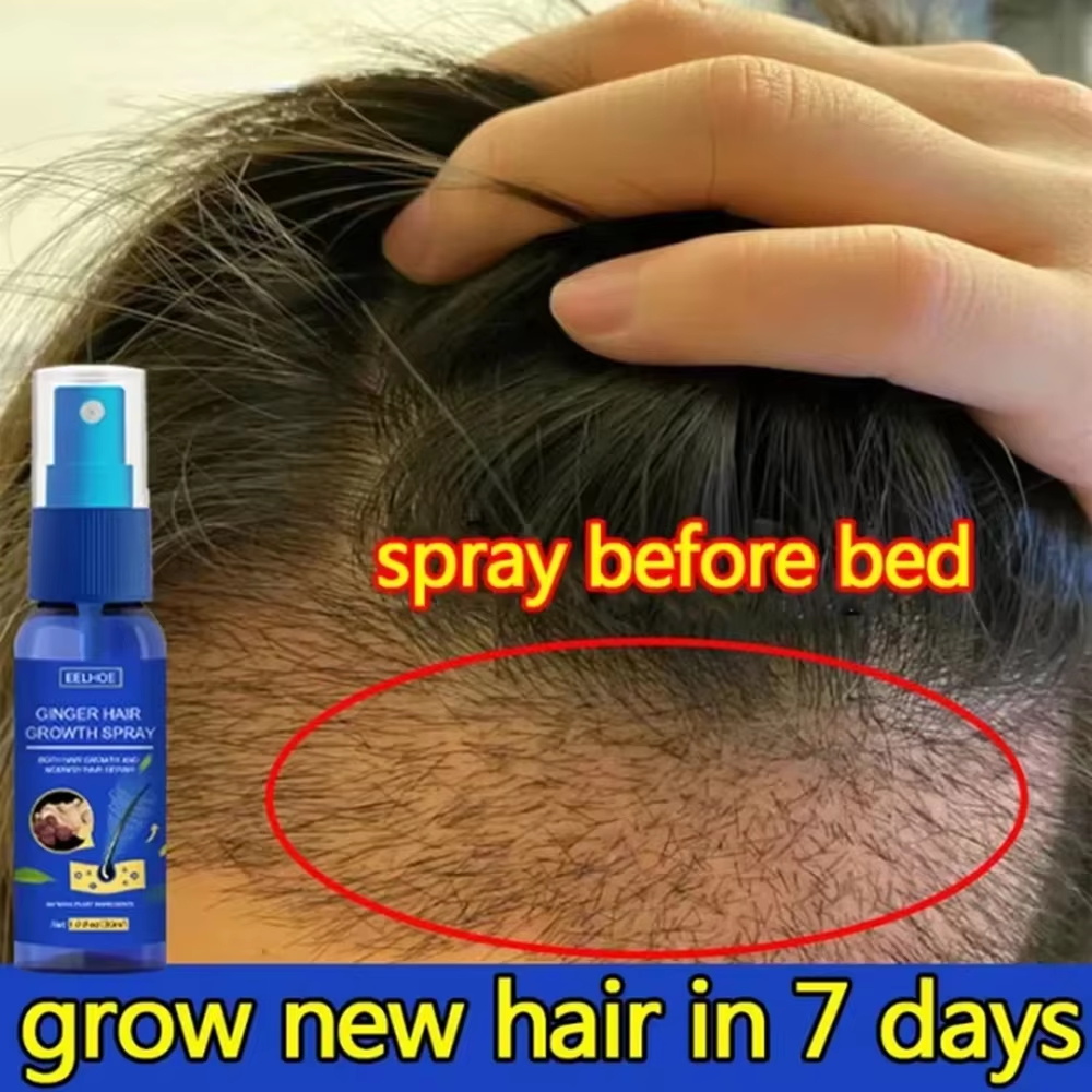 Ginger Hair Growth spray Anti  - Hair Care With Protein recensie en prijs