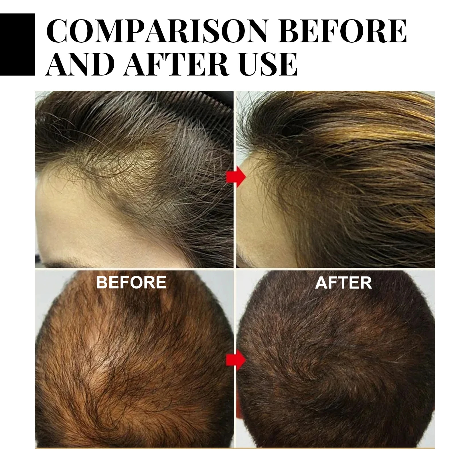 Ginger Hair Growth spray Anti  - Hair Care With Protein recensie en prijs