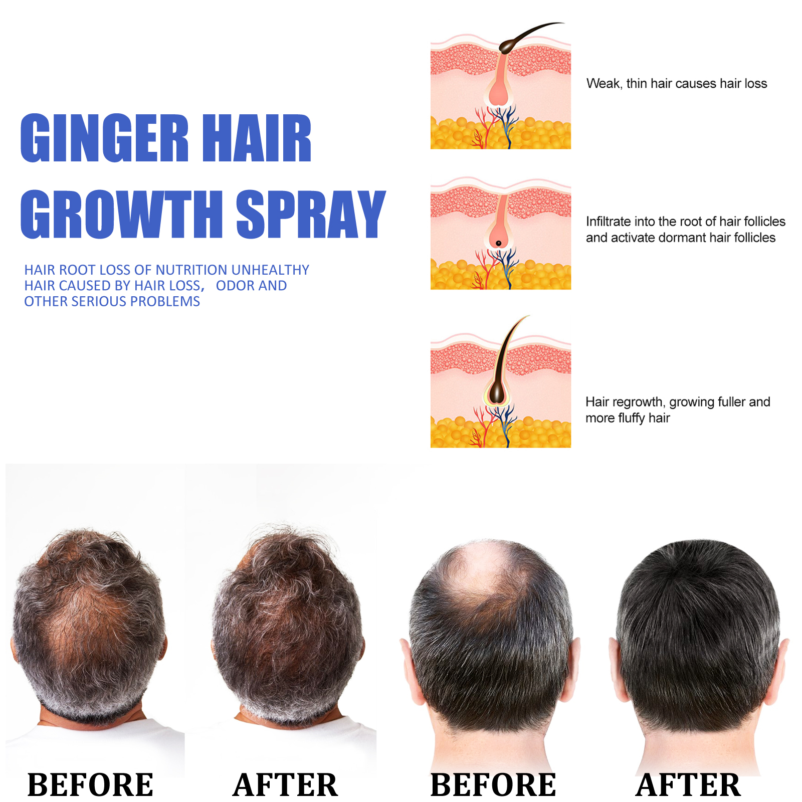 Ginger Hair Growth spray Anti  - Hair Care With Protein recensie en prijs