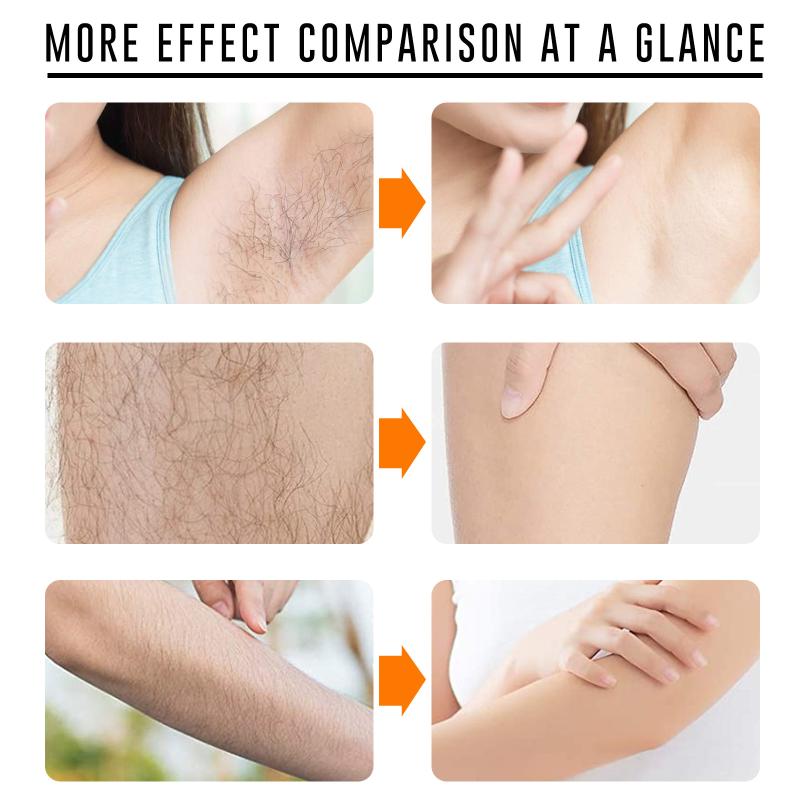 Fast Hair Removal Spray Painle - Hair Care Spray recensie en prijs